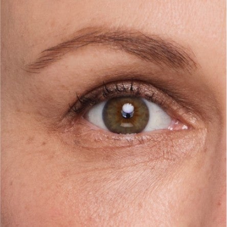 Close up of model's undereye area. 