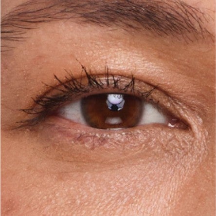 Close up of model's undereye area. 