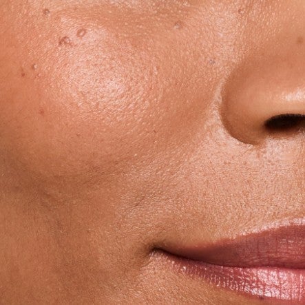 Close up of model's smile lines.